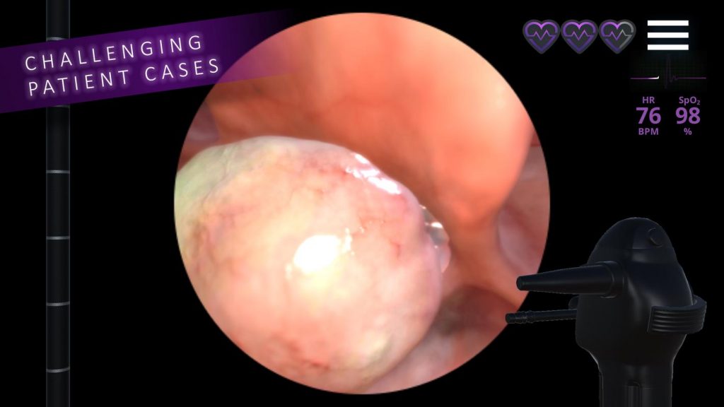 Airway EX Virtual Surgery screenshot 5