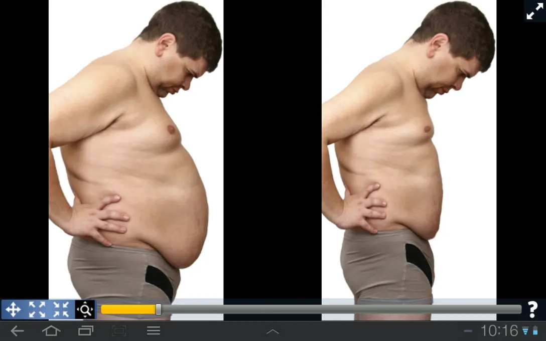 Plastic Surgery Simulator screenshot 3